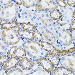 Anti-PEX5 antibody used in IHC (Paraffin sections) (IHC-P). GTX33404
