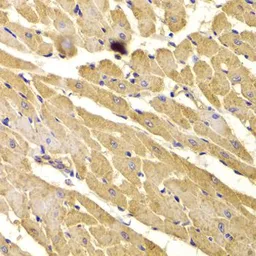 Anti-PEX5 antibody used in IHC (Paraffin sections) (IHC-P). GTX33404