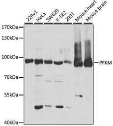 Anti-PFKM antibody used in Western Blot (WB). GTX33405