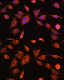 Anti-PFKM antibody used in Immunocytochemistry/ Immunofluorescence (ICC/IF). GTX33405