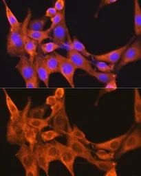 Anti-PFKM antibody used in Immunocytochemistry/ Immunofluorescence (ICC/IF). GTX33405