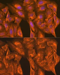 Anti-PFKM antibody used in Immunocytochemistry/ Immunofluorescence (ICC/IF). GTX33405