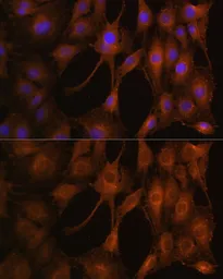 Anti-PFKM antibody used in Immunocytochemistry/ Immunofluorescence (ICC/IF). GTX33405