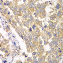 Anti-PFKM antibody used in IHC (Paraffin sections) (IHC-P). GTX33405