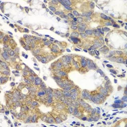 Anti-PFKM antibody used in IHC (Paraffin sections) (IHC-P). GTX33405