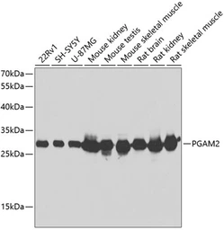 Anti-PGAM2 antibody used in Western Blot (WB). GTX33406