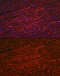 Anti-PGAM2 antibody used in IHC (Paraffin sections) (IHC-P). GTX33406