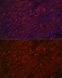 Anti-PGAM2 antibody used in IHC (Paraffin sections) (IHC-P). GTX33406