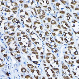 Anti-PGLS antibody used in IHC (Paraffin sections) (IHC-P). GTX33407