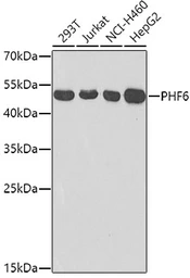 Anti-PHF6 antibody used in Western Blot (WB). GTX33408