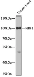 Anti-PIBF1 antibody used in Western Blot (WB). GTX33409