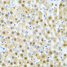 Anti-PIBF1 antibody used in IHC (Paraffin sections) (IHC-P). GTX33409