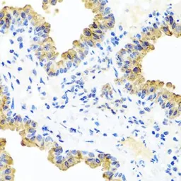 Anti-PIP4K2B antibody used in IHC (Paraffin sections) (IHC-P). GTX33410