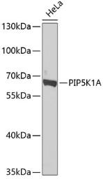 Anti-PIP5K1A antibody used in Western Blot (WB). GTX33411