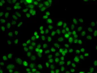Anti-PIP5K1A antibody used in Immunocytochemistry/ Immunofluorescence (ICC/IF). GTX33411