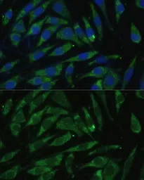 Anti-PITRM1 antibody used in Immunocytochemistry/ Immunofluorescence (ICC/IF). GTX33412