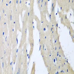 Anti-PITRM1 antibody used in IHC (Paraffin sections) (IHC-P). GTX33412