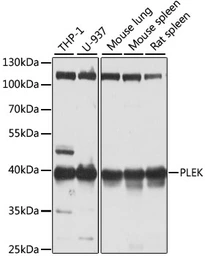 Anti-Pleckstrin antibody used in Western Blot (WB). GTX33414