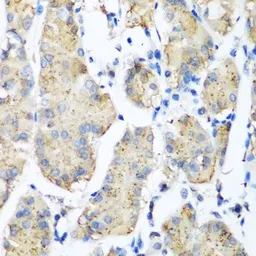 Anti-Pleckstrin antibody used in IHC (Paraffin sections) (IHC-P). GTX33414
