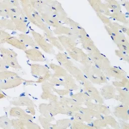 Anti-Pleckstrin antibody used in IHC (Paraffin sections) (IHC-P). GTX33414