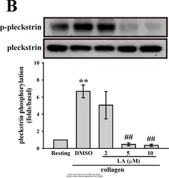 Anti-Pleckstrin antibody used in Western Blot (WB). GTX33414