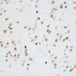 Anti-PLZF antibody used in IHC (Paraffin sections) (IHC-P). GTX33417
