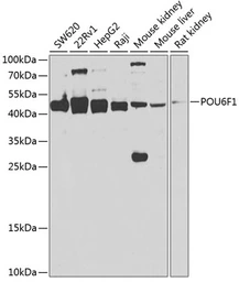 Anti-POU6F1 antibody used in Western Blot (WB). GTX33420