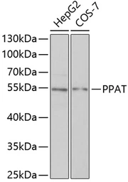 Anti-PPAT antibody used in Western Blot (WB). GTX33422