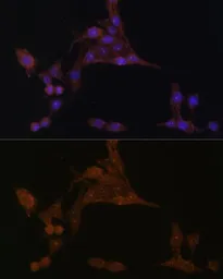 Anti-PPAT antibody used in Immunocytochemistry/ Immunofluorescence (ICC/IF). GTX33422