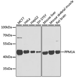 Anti-PPM1A antibody used in Western Blot (WB). GTX33423