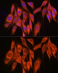 Anti-PPM1A antibody used in Immunocytochemistry/ Immunofluorescence (ICC/IF). GTX33423
