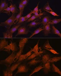 Anti-PPM1A antibody used in Immunocytochemistry/ Immunofluorescence (ICC/IF). GTX33423