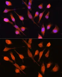 Anti-PPM1A antibody used in Immunocytochemistry/ Immunofluorescence (ICC/IF). GTX33423