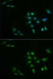 Anti-PPOX antibody used in Immunocytochemistry/ Immunofluorescence (ICC/IF). GTX33424