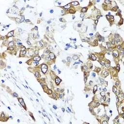 Anti-PPOX antibody used in IHC (Paraffin sections) (IHC-P). GTX33424