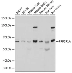 Anti-PPP2R1A antibody used in Western Blot (WB). GTX33425
