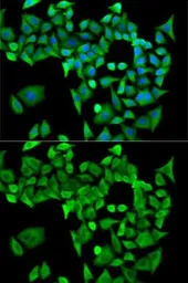 Anti-PPP2R1A antibody used in Immunocytochemistry/ Immunofluorescence (ICC/IF). GTX33425