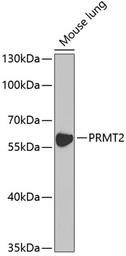 Anti-PRMT2 antibody used in Western Blot (WB). GTX33427