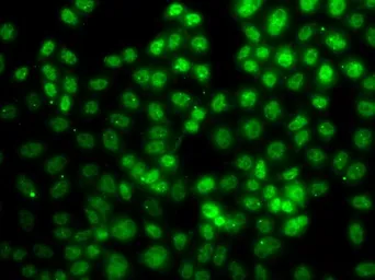 Anti-PRMT2 antibody used in Immunocytochemistry/ Immunofluorescence (ICC/IF). GTX33427