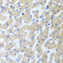 Anti-PRMT2 antibody used in IHC (Paraffin sections) (IHC-P). GTX33427