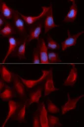 Anti-Proteasome beta 4 antibody used in Immunocytochemistry/ Immunofluorescence (ICC/IF). GTX33431
