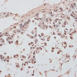 Anti-PRPF31 antibody used in IHC (Paraffin sections) (IHC-P). GTX33433