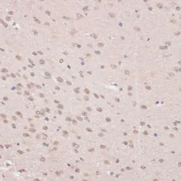 Anti-PRPF31 antibody used in IHC (Paraffin sections) (IHC-P). GTX33433