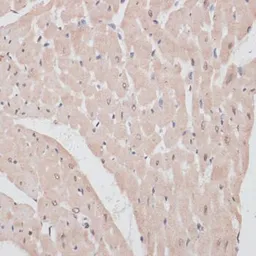 Anti-PRPF31 antibody used in IHC (Paraffin sections) (IHC-P). GTX33433