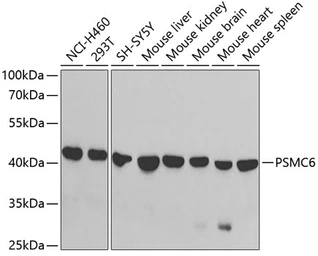 Anti-PSMC6 antibody used in Western Blot (WB). GTX33436