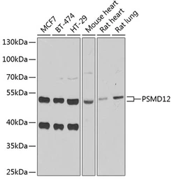 Anti-PSMD12 antibody used in Western Blot (WB). GTX33437