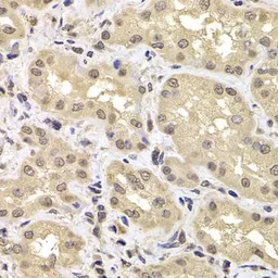 Anti-PSMD12 antibody used in IHC (Paraffin sections) (IHC-P). GTX33437