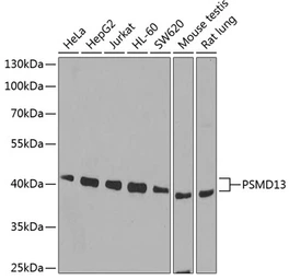 Anti-PSMD13 antibody used in Western Blot (WB). GTX33438