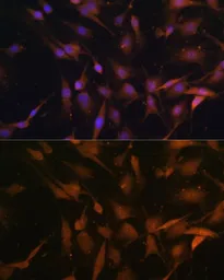 Anti-PSMD13 antibody used in Immunocytochemistry/ Immunofluorescence (ICC/IF). GTX33438