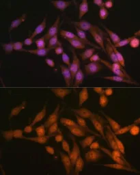 Anti-PSMD13 antibody used in Immunocytochemistry/ Immunofluorescence (ICC/IF). GTX33438